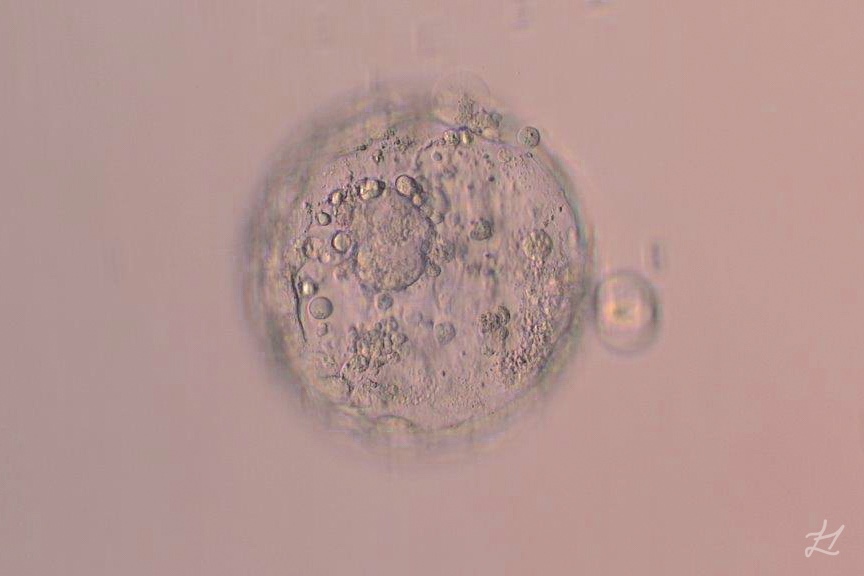 Our little 4BC embryo