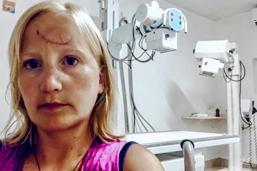 Me in the X-ray room at Buzios Hospital