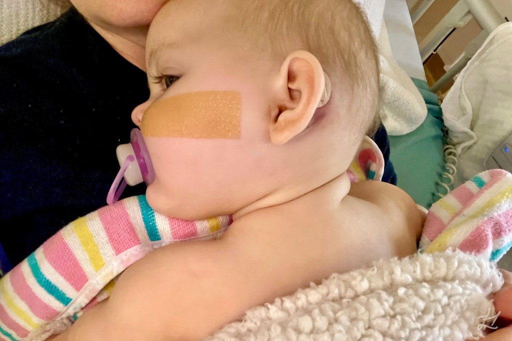 Kaydence's mastoiditis ear after surgery